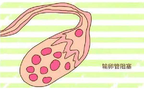 2022北京供卵机构 北京家恩德运医院试管移植条件 ‘胎囊32x21x44是男孩女孩’